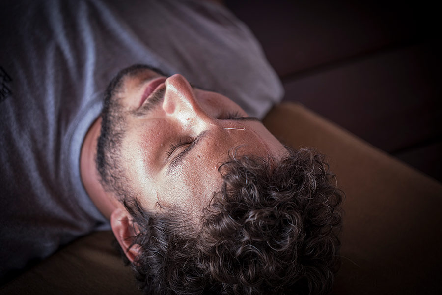 Man receives acupuncture